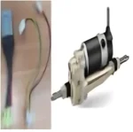 Motor + E.M.B Assy. F Power Unit 9.3 mph Replacement Part for Afiscooter Afikim SE